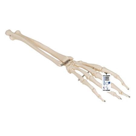 Hand Skeleton Ulna And Radius - W/ 3B Smart Anatomy